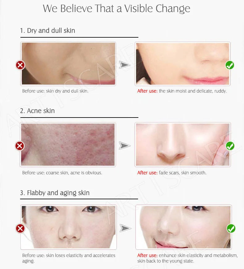 ARTISCARE Vitamin C Serum+Hyaluronic Acid Serum Aging Moisturizing Skin Care Firming Treatment Moisturizing 4PCS