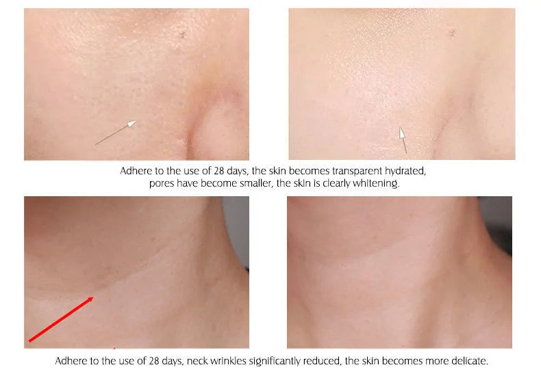 ARTISCARE Vitamin C Serum+Hyaluronic Acid Serum Aging Moisturizing Skin Care Firming Treatment Moisturizing 4PCS