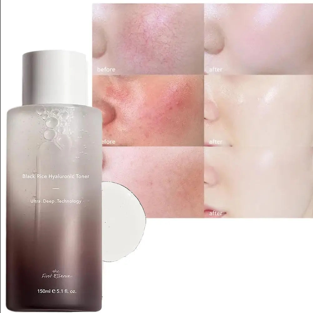 Haruharu Wonder Black Rice Hyaluronic Acid Toner Sensitive Skin Facial Moisturizing Improves Dull Skin Tone Soothing Skin Care